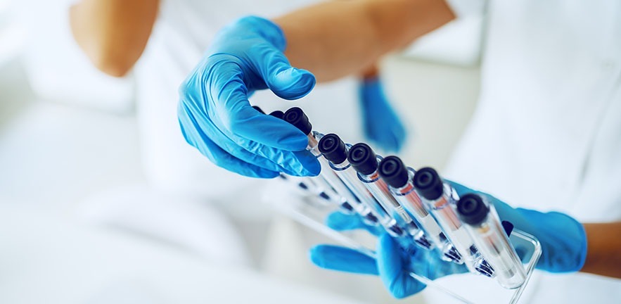 Close up of lab assistant with sterile rubber gloves holding stand with test tubes with blood samples.